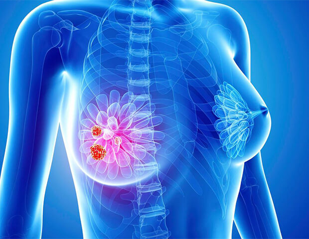 ПРИГЛАШАЕМ НА ДЕНЬ ОТКРЫТЫХ ДВЕРЕЙ по раннему выявлению рака молочной железы - Амбулаторный центр г. Усть-Каменогорск